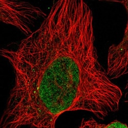 PM20D2 Antibody, Novus Biologicals 0.1mL; Unlabeled:Antibodies, Polyclonal